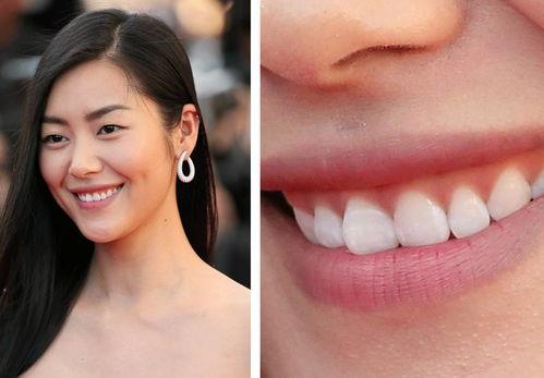 明星的牙,揭秘明星牙齿的秘密